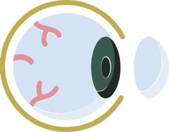 Cornea